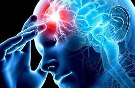 Домедична допомога при гострому мозковому інсульті: що важливо робити і від чого слід утриматися