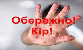 ЩО ТРЕБА ЗНАТИ ПРО КІР