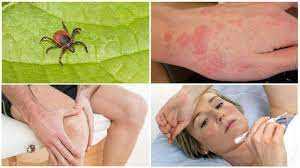 ХВОРОБА ЛАЙМА