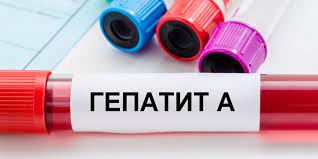 Як вберегти себе від гепатиту А і що робити, якщо ви підозрюєте у себе симптоми?